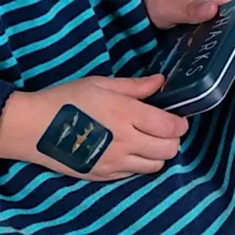 Plaster applied to a kids' hand with a sharks-themed design.